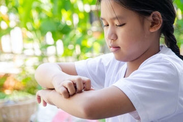 Why Mosquitoes Bite Some People More Than Others — And What to Do If They Love You