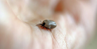 Tick Prevention and Lyme Disease Symptoms
